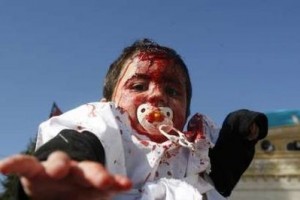 ashura 10- 2 Shiite child seen bleeding
